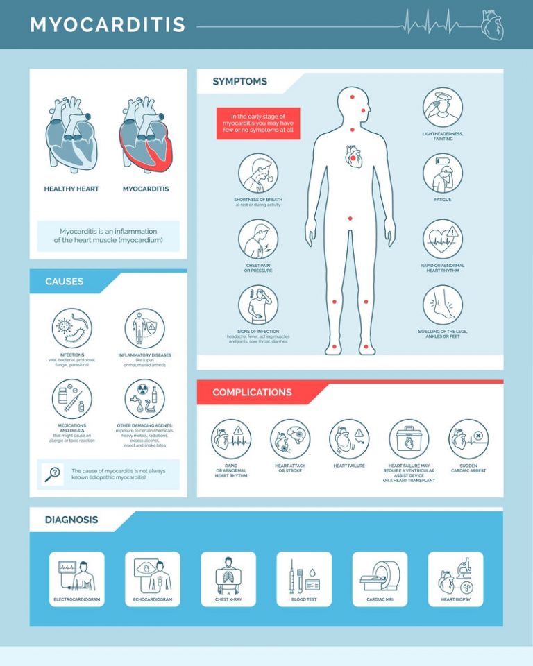 Myocarditis: What Are The Symptoms, Causes And Treatment