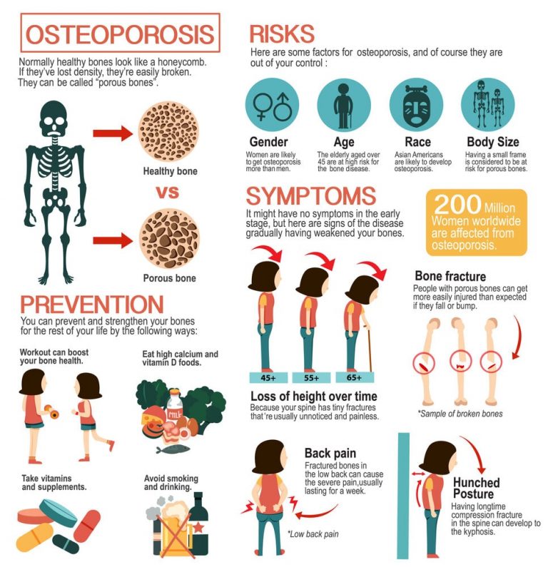 Can Osteoporosis Be Reversed: Know More In Details