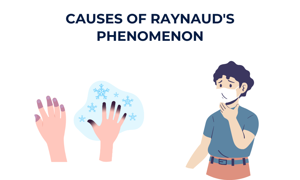 Raynaud's phenomenon